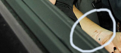 Lindsay Lohan cuts himself Lindsay Lohan cuts himself